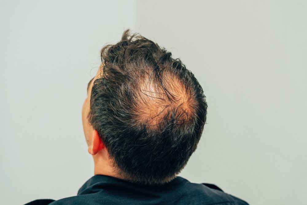 Mulher olhando o cabelo com expressão de preocupação e esperança